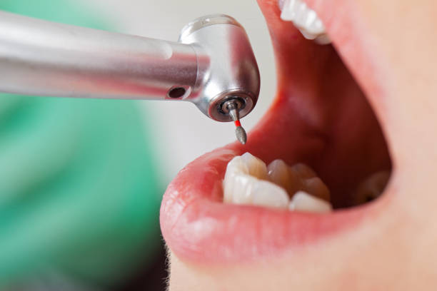 Best Same-Day Emergency Dentist in Louise, TX